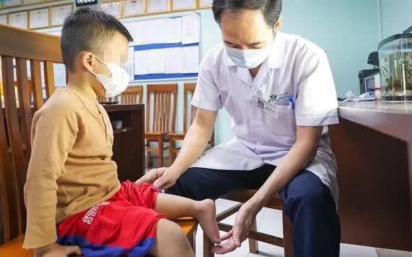 Xoay cẳng chân 180 độ tạo khớp gối mới cho bé trai 5 tuổi- Ảnh 1.