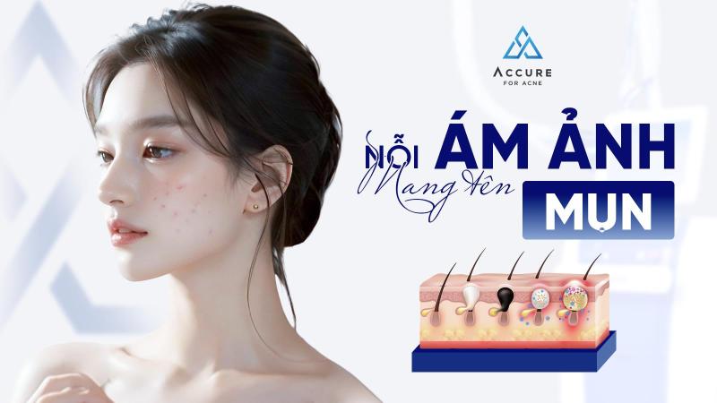 TRANFA chính thức đưa công nghệ laser bước sóng 1726nm phá hủy tuyến bã Accure về Việt Nam- Ảnh 1. TRANFA chính thức đưa công nghệ laser bước sóng 1726nm phá hủy tuyến bã Accure về Việt Nam- Ảnh 1.