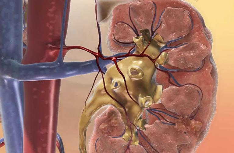 Nữ sinh năm nhất mắc suy thận giai đoạn cuối, phải chạy thận cả đời: Bác sĩ cảnh báo thứ mà ai cũng hay bỏ qua- Ảnh 1.