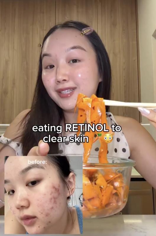 Bát salad 5’ tạo retinol dồi dào, mặt giảm hẳn mụn mà da vẫn lành- Ảnh 1.