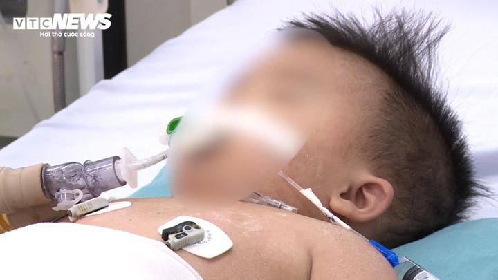 Bác sĩ chỉ cách phòng bệnh cho trẻ nhỏ thời điểm giao mùa- Ảnh 2.