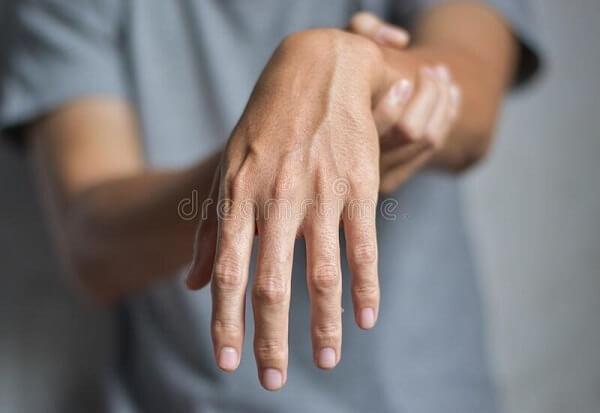 Ngủ gật 30 phút trong giờ làm, người đàn ông 37 tuổi bỗng liệt dây thần kinh, không nhấc nổi cổ tay- Ảnh 3.