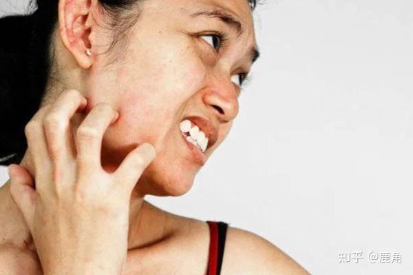 Người đàn ông 40 tuổi phát hiện ung thư gan giai đoạn cuối: Đáng tiếc ông đã bỏ qua dấu hiệu suốt 3 tháng- Ảnh 3.