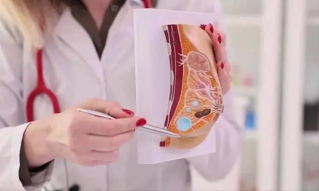 Phụ nữ sống thọ hay không, nhìn vào vòng 1 là thấy: 3 dấu hiệu ở ngực nhiều chị em xem nhẹ nhưng lại là “đèn đỏ” sức khỏe- Ảnh 3.
