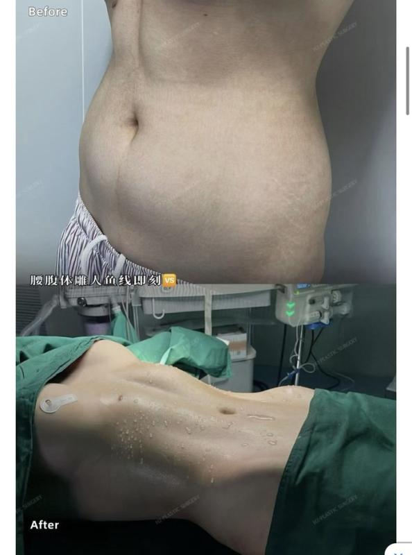 Xu hướng làm đẹp kinh dị đang thịnh hành của mỹ nhân - Ảnh 1.