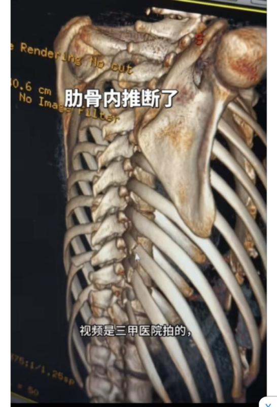 Xu hướng làm đẹp kinh dị đang thịnh hành của mỹ nhân - Ảnh 2.