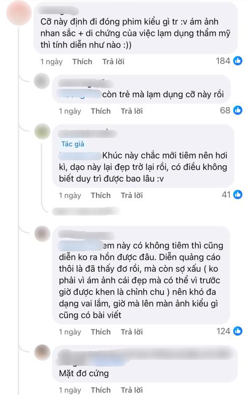 Đôi môi bất thường của Jang Wonyoung- Ảnh 7.