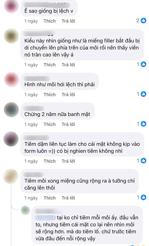 Đôi môi bất thường của Jang Wonyoung- Ảnh 8.
