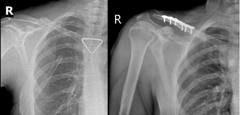 Thêm 1 du khách người Nga được bác sĩ cấp cứu kịp thời- Ảnh 2.