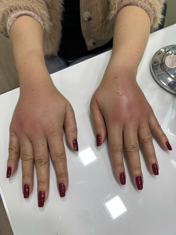 Tin quảng cáo “bật tông nhanh”, nhiều người biến dạng mặt vì làm đẹp cận Tết- Ảnh 2.