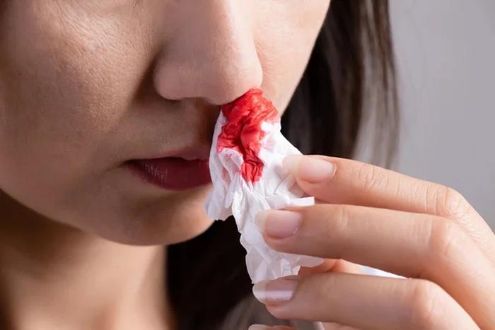 Dấu hiệu cảnh báo ung thư vòm họng tuyệt đối không nên bỏ qua- Ảnh 3.