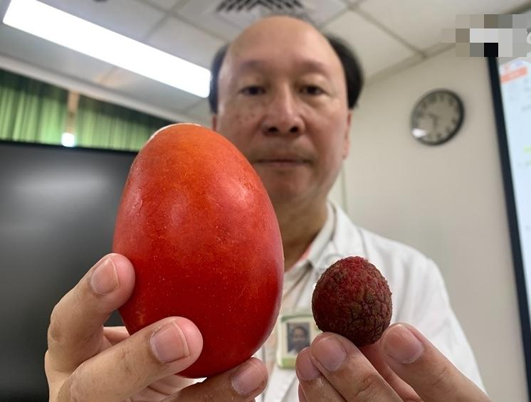 1 thứ trên người nam thanh niên đang bé như quả vải bỗng to như quả xoài, phát hiện ung thư tinh hoàn dù KHÔNG đau, KHÔNG ngứa- Ảnh 2.