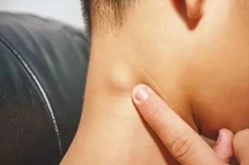 Bé gái 9 tuổi qua đời vì ung thư, bác sĩ tiết lộ sự thật đáng sợ: Bệnh này THÍCH "tấn công" trẻ em- Ảnh 3.