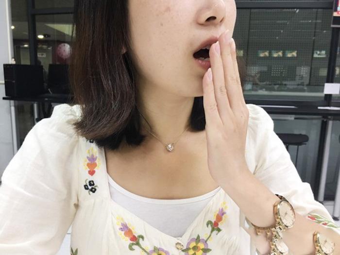 Ngày càng nhiều người còn trẻ đã chết vì ung thư gan? Bác sĩ nhắc: Đừng bỏ lỡ "2 hôi, 2 ngứa, 2 đỏ" đang báo bệnh- Ảnh 3.