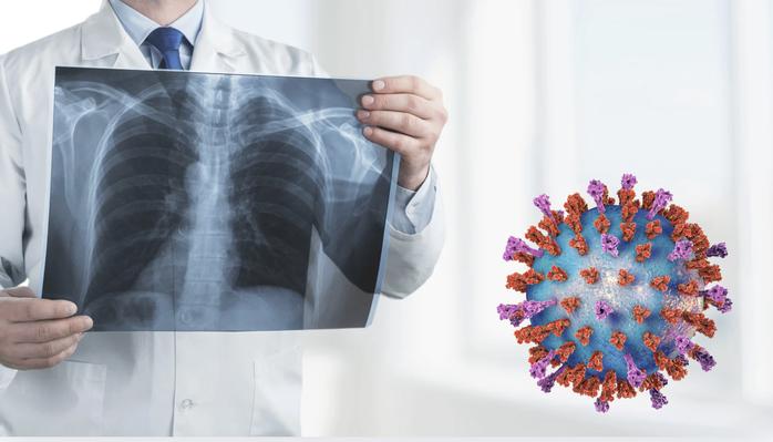 Viêm hô hấp cấp rình rập ngày Tết- Ảnh 1.