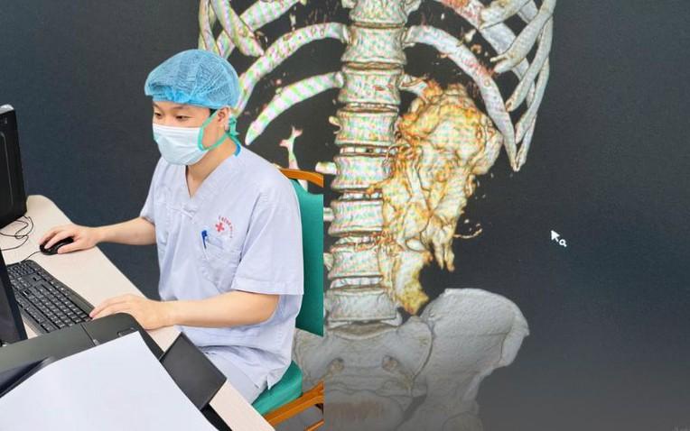 "Bác sĩ ơi cứu em, nhưng... cho em về ăn Tết xong mổ được không": Lời cầu khẩn khiến bác sĩ khoa Thận-Tiết niệu và Nam học lặng người trước thềm năm mới- Ảnh 1.