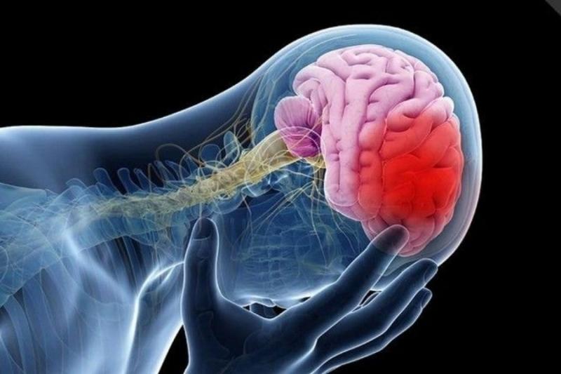 Sau hóa vàng, người đàn ông tê tay tưởng say rượu nên uống chanh mật ong: Sáng hôm sau bác sĩ báo ĐỘT QUỴ- Ảnh 3.