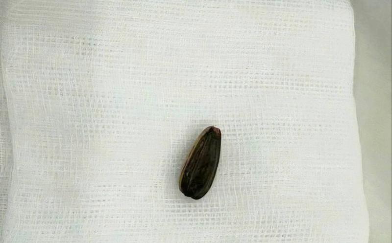 Bé 3 tuổi nguy kịch vì loại hạt thường có trên bàn tiếp khách dịp Tết- Ảnh 3.