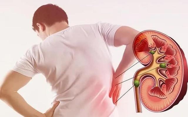 "Cầm dao mổ rồi mới thấy, nhiều quả thận ra đi mãi oan uổng chỉ vì thiếu hiểu biết": 30 cảnh báo từ BS phòng mổ, ai cũng phải đọc- Ảnh 1.