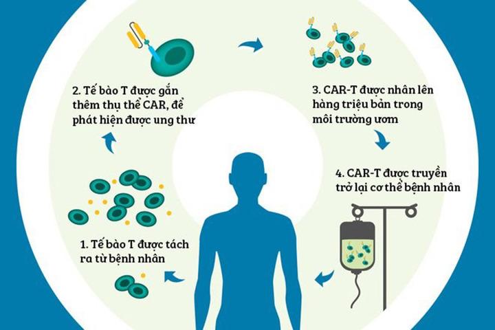 Liệu pháp CAR-T được dùng điều trị ung thư máu là gì?- Ảnh 1.