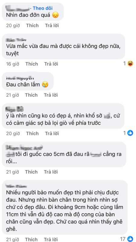 Barbie đời thực cũng khổ như búp bê: Nhìn bàn chân dị dạng vì giày cao gót mà đau dùm- Ảnh 6.