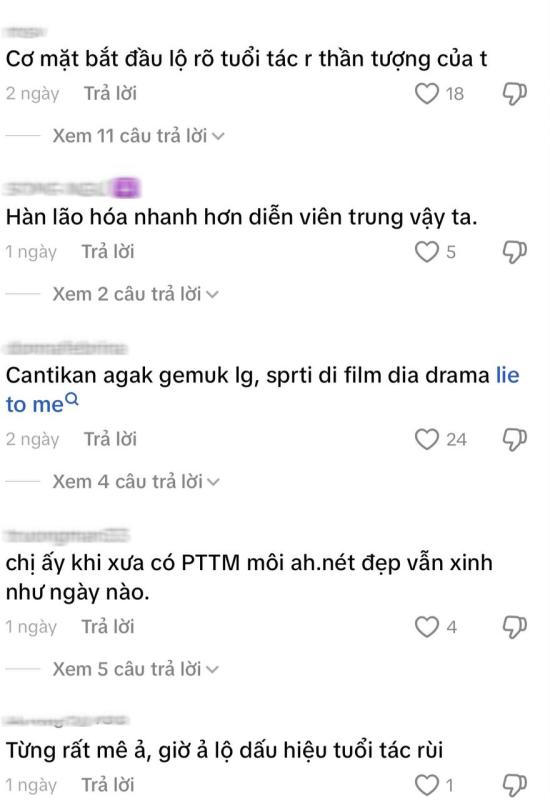 Thái tử phi đẹp nhất Hàn Quốc lộ dấu hiệu lão hóa, netizen vào bênh ngay- Ảnh 4.
