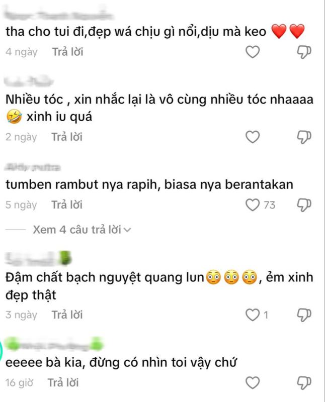 Khi Chương Nhược Nam hết làm bạch nguyệt quang: Nhìn cứ hao hao Go Youn Jung thế này!- Ảnh 6.