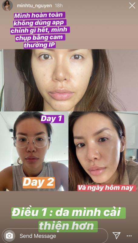 Minh Tú tuổi 34 phục hồi da thành công, mặt căng bóng rạng rỡ nhờ loại nước có nguyên liệu bán đầy ngoài chợ- Ảnh 4.