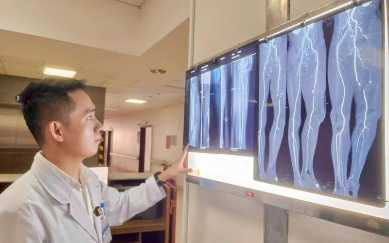 5 giờ nỗ lực giữ lại chi cho bệnh nhân trước nguy cơ cắt bỏ- Ảnh 1.