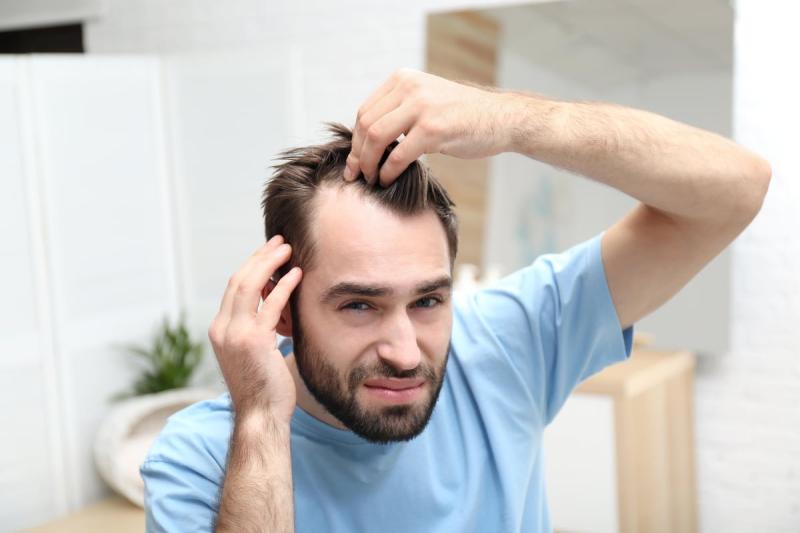 Hàng triệu người bị hói sớm chỉ vì 1 thói quen vô cùng phổ biến- Ảnh 1.
