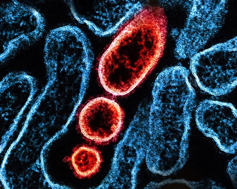 Phát hiện virus mới âm thầm lây từ dơi sang người, bị nhầm với virus Nipah- Ảnh 2.