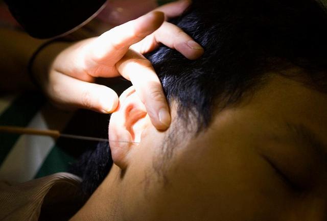 Người đàn ông 30 tuổi tai chảy dịch có mùi lạ vì thói quen nhiều người làm vài giờ mỗi ngày- Ảnh 2.