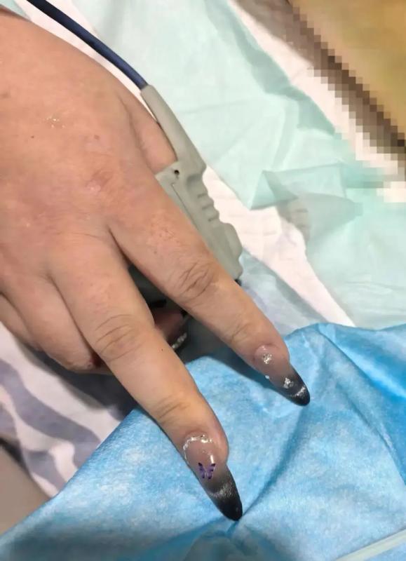 Cô gái 28 tuổi bị ngưng tim, bất ngờ khi thợ làm móng được gọi đến Cô gái 28 tuổi bị ngưng tim, bất ngờ khi thợ làm móng được gọi đến