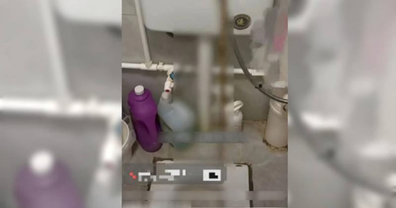 Người phụ nữ 32 tuổi đi ngoài ra sán dài tới 3 mét dù chưa từng ăn đồ sống, bác sĩ chỉ ra 1 thứ bếp nhà nào cũng có chính là thủ phạm- Ảnh 1.