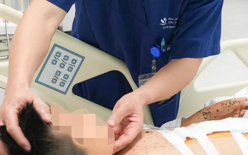 Bé trai 9 tuổi nguy kịch do kíp nổ tự chế- Ảnh 1.