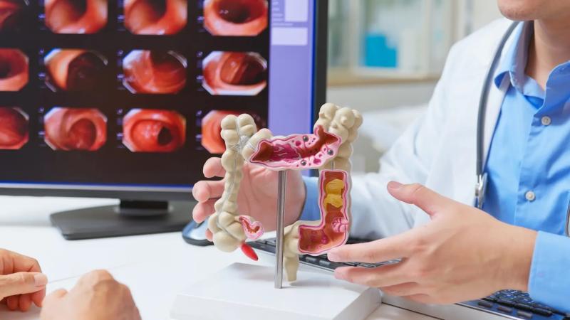Những người dưới 50 tuổi chú ý: 6 triệu chứng này có thể là dấu hiệu của ung thư- Ảnh 2.