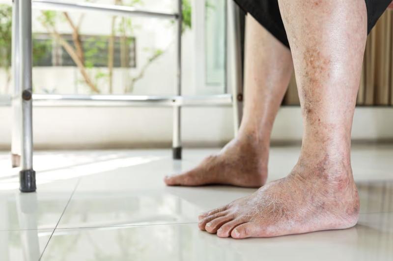 Gan "kêu cứu" bằng cách phát ra dấu hiệu này ở chân: Kiểm tra ngay xem bạn có không- Ảnh 1.