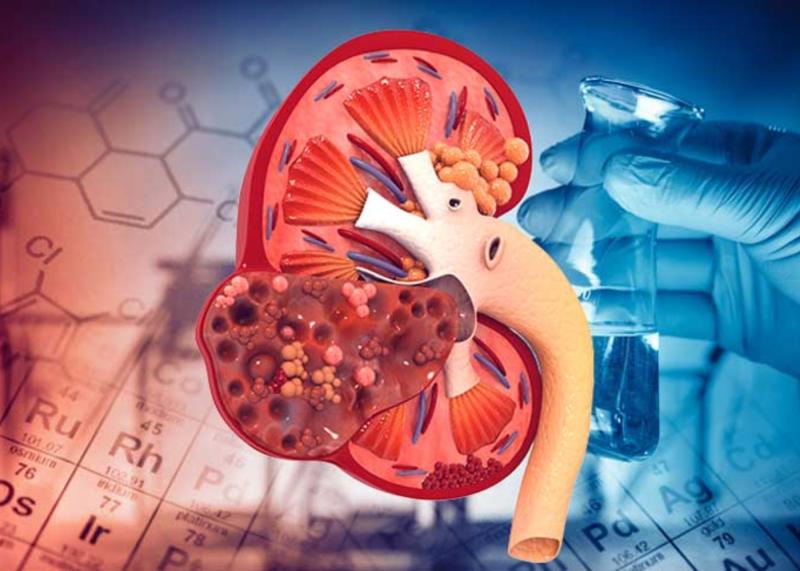 12 dấu hiệu thận đang “kêu cứu” âm thầm: Điều cuối cùng nhiều người chủ quan, đến viện thì đã muộn- Ảnh 3.