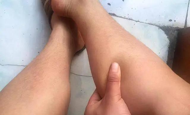 Rau thì là có gây suy thận? Các bác sĩ cảnh báo: Để tránh tổn thương thận, hãy ăn ít 3 loại rau này- Ảnh 3. Rau thì là có gây suy thận? Các bác sĩ cảnh báo: Để tránh tổn thương thận, hãy ăn ít 3 loại rau này- Ảnh 3.