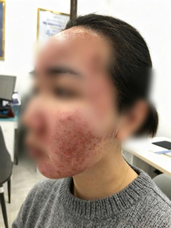 Cơn ác mộng của thiếu nữ chỉ sau vài giờ được mời làm đẹp cấp tốc đón Tết- Ảnh 1.