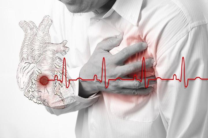 Đột quỵ dễ nhầm cơn say ngày Tết, bác sĩ chỉ dấu hiệu 'then chốt' giúp phân biệt- Ảnh 1.