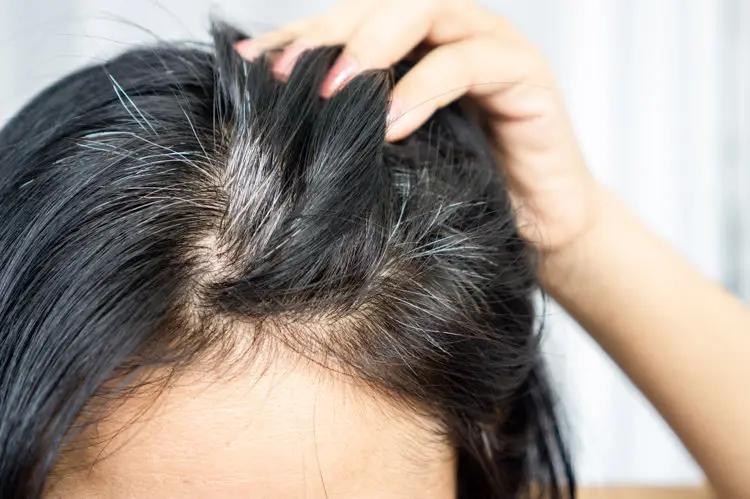 Liệu người tóc bạc ít khả năng mắc ung thư hơn? Có bằng chứng khoa học nào không? Câu trả lời đã có ở đây- Ảnh 2.