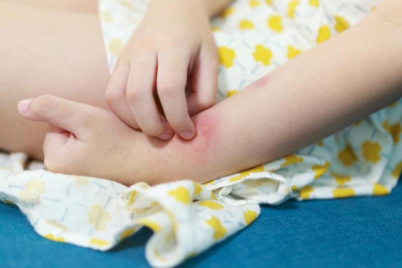 Thời tiết miền Bắc bước vào chuỗi ngày nồm ẩm: Cẩn trọng với nhiều bệnh lây truyền- Ảnh 3.
