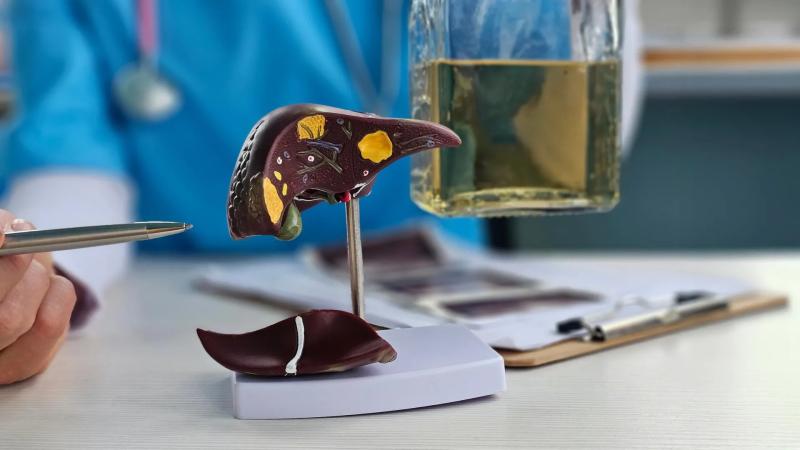 1 dấu hiệu cảnh báo sớm bệnh gan chỉ xuất hiện vào buổi tối- Ảnh 2.