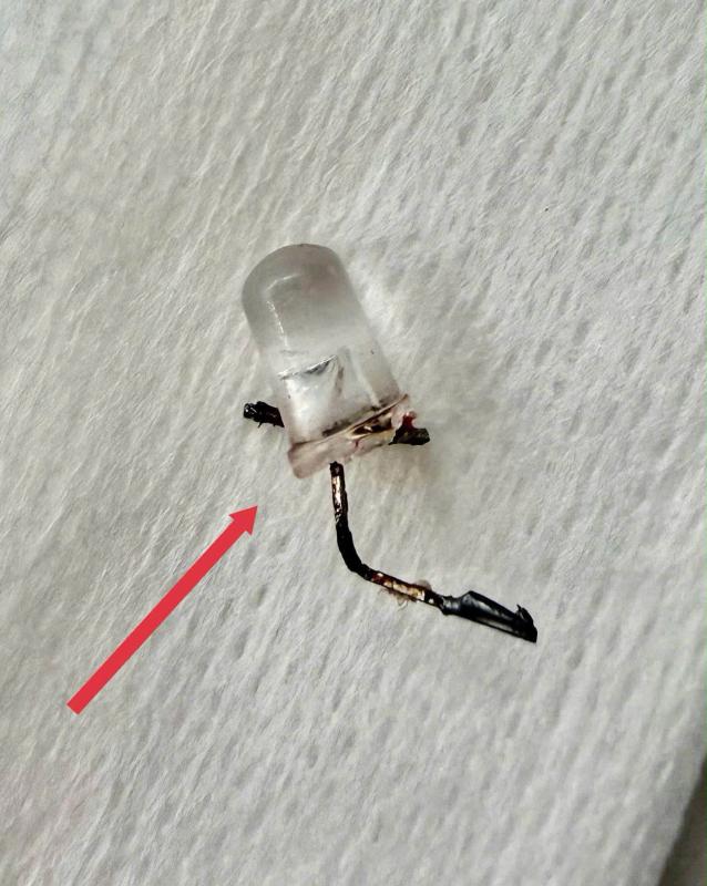 Bác sĩ thót tim gắp đèn led nằm trong phế quản bé 9 tháng tuổi - Ảnh 2.
