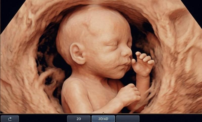 Bác sĩ nghẹn lòng trước mong muốn của sản phụ: "Bác… cố chụp cho con em một tấm ảnh thật đẹp… để làm kỷ niệm" - Ảnh 2.