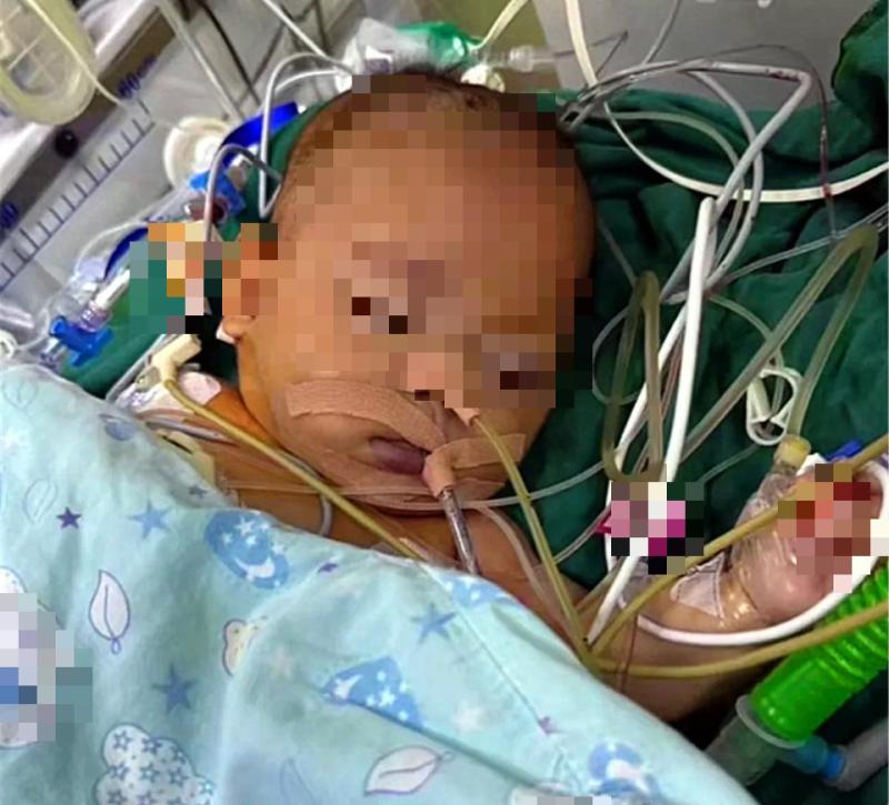 Kỳ lạ em bé 5 tháng tuổi nôn mửa và chán ăn nhưng không khóc tiếng nào, bác sĩ phát hiện sự thật đáng sợ phía sau- Ảnh 2.