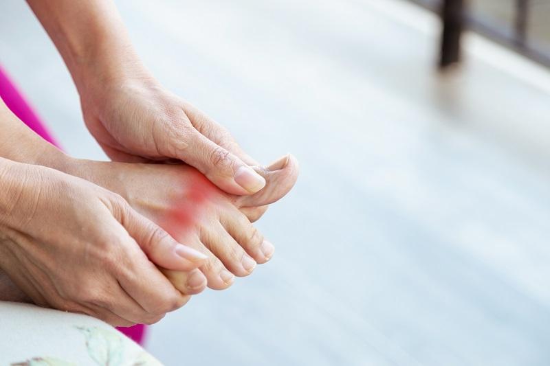Chế độ ăn cho người bị bệnh gout: Khuyên dùng 4 “cao thủ” hạ axit uric, đậu phụ là một trong số đó- Ảnh 1.