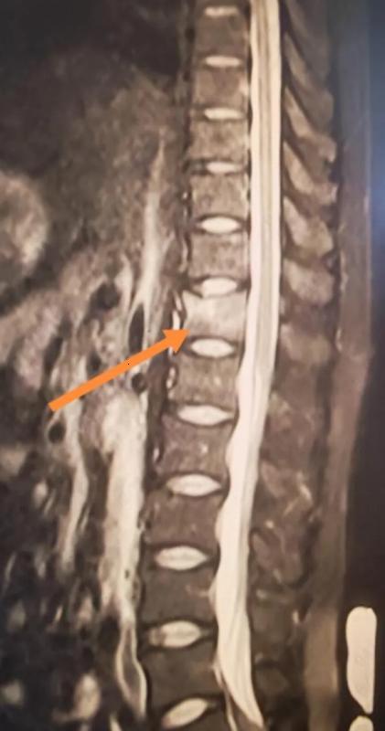 Người đàn ông 34 tuổi xương giòn như bà cụ 60 tuổi vì ngày nào cũng uống 3 cốc loại nước nhiều người không thể sống thiếu - Ảnh 1.