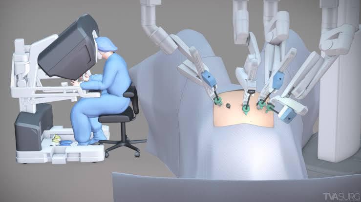 Mổ bằng robot có thực sự tốt hơn không? - Ảnh 2.